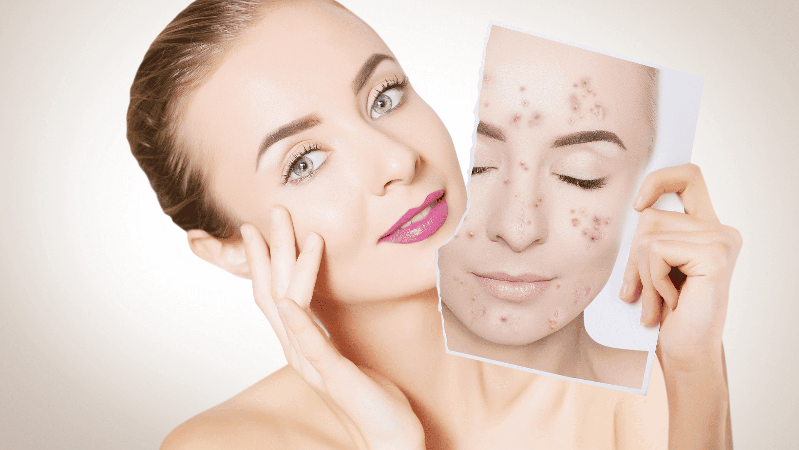 6-effective-ways-to-treat-acne-barbies-beauty-bits