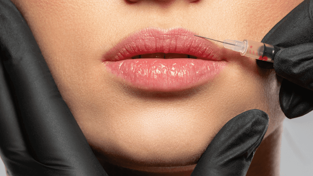 best lip fillers, barbies beauty bits