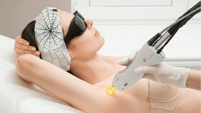 how-does-laser-hair-removal-work-barbies-beauty-bits