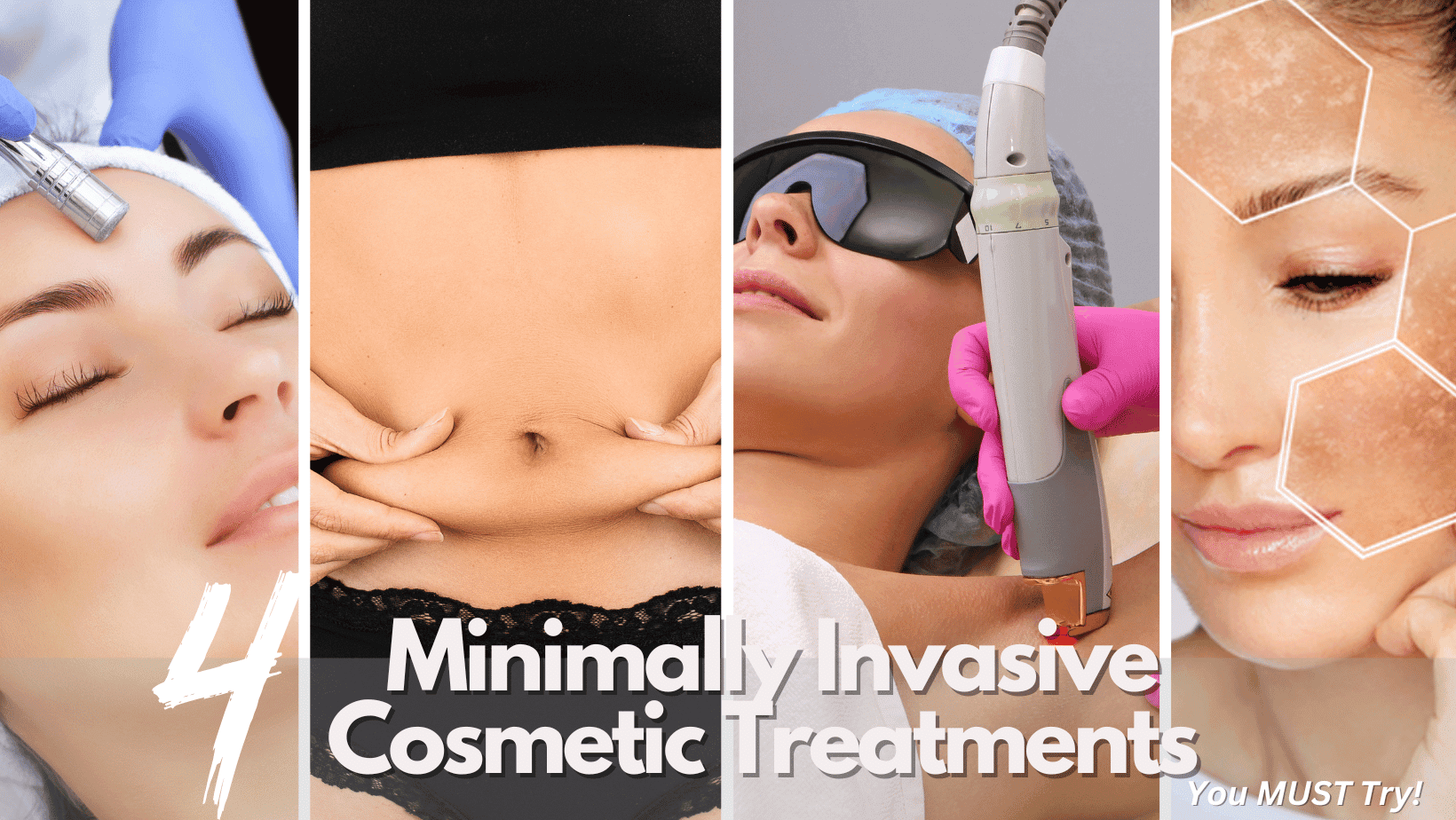 top-4-minimally-invasive-cosmetic-treatments-you-must-try-barbies-beauty-bits